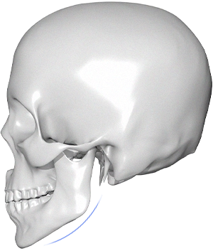 黒背景に白い頭蓋骨の側面図。345 Plastic Surgeryが提供する美容整形手術のイメージ。顔の骨格構造を示し、顎のラインを強調。美容医療、輪郭形成の参考資料。