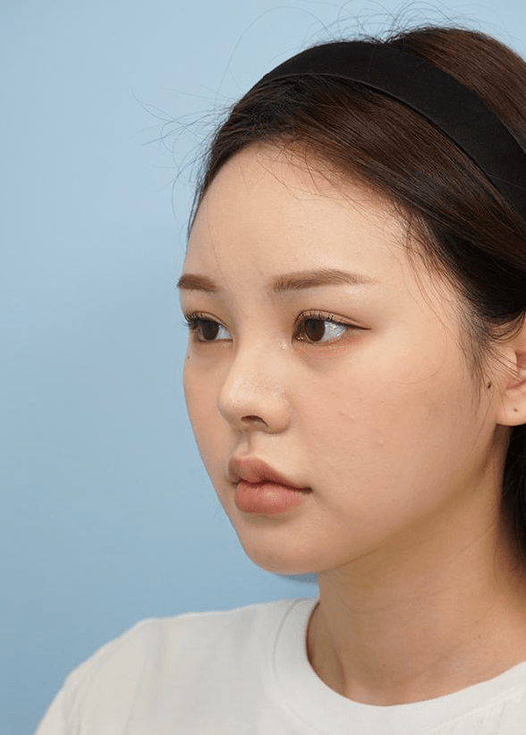 顔の輪郭と鼻の形状が際立つ女性の横顔。黒いヘアバンドが特徴的。345 Plastic Surgeryでは、個々の骨格に合わせた美容整形を提供。顔の印象を整え、美しさを引き出す施術を検討中の方へ。