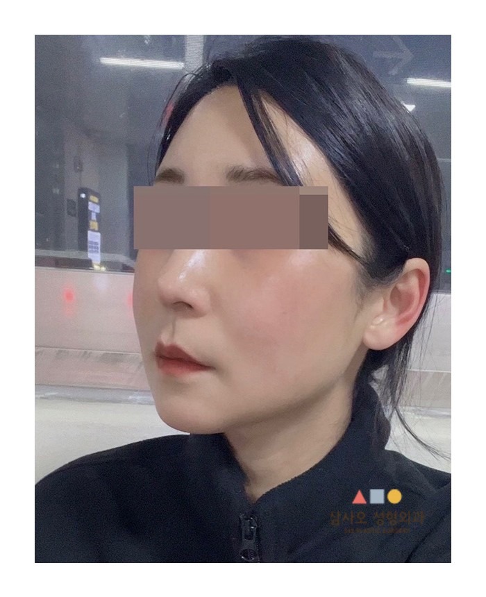 contouring