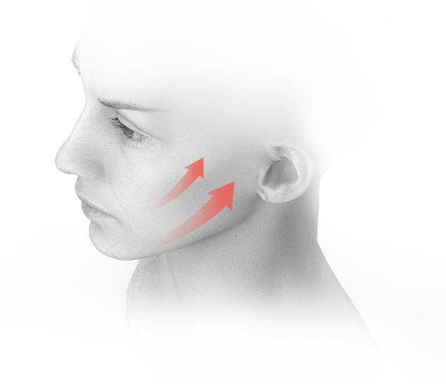 女性の顔の横顔、赤い矢印が頬からこめかみに向かう。345 Plastic Surgeryが提供するフェイスリフトや美容整形手術のイメージ。顔のたるみ改善、若返り効果を示す。