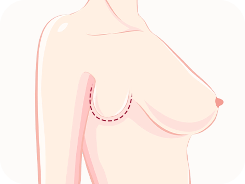 女性の胸部イラスト