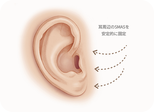 耳の固定方法図示