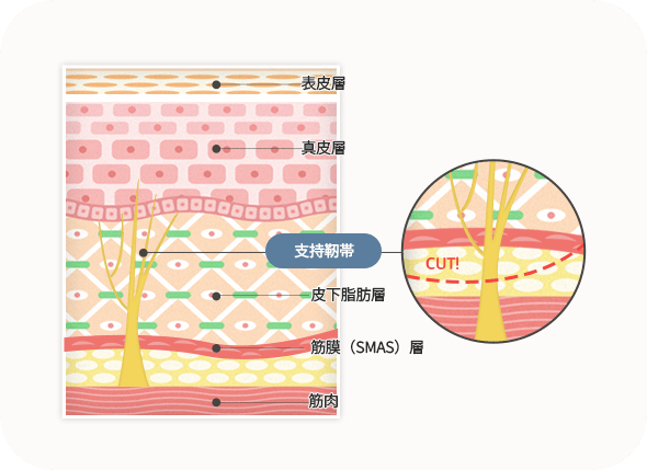 皮膚の断面図とその層