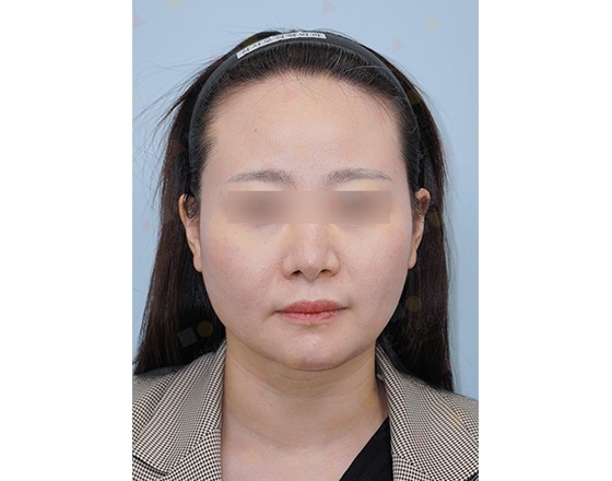 Woman with headband facing camera.
