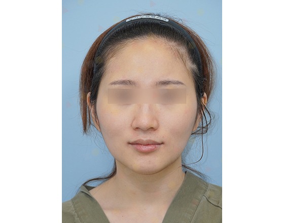 Person with blurred eyes wearing headband, neutral expression.