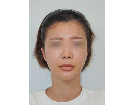 Person with blurred eyes and short hair.