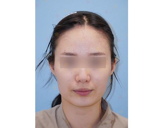 Portrait of person with blurred eyes on blue background.