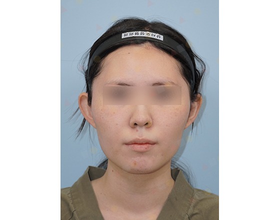 Person facing camera with blurred eyes, wearing headband.