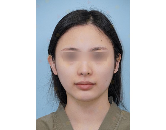 Woman with blurred eyes on blue background