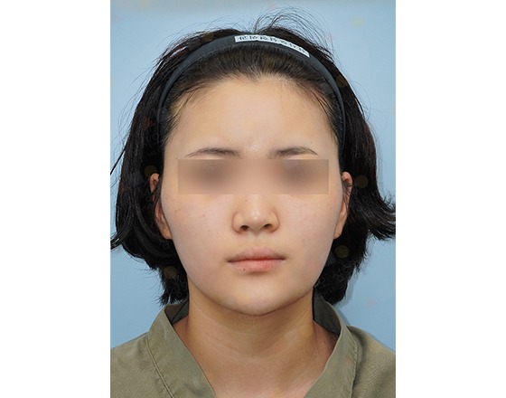 Person with short hair wearing headband, neutral expression.