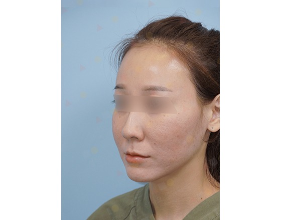 Profile of woman with blurred eyes facing left