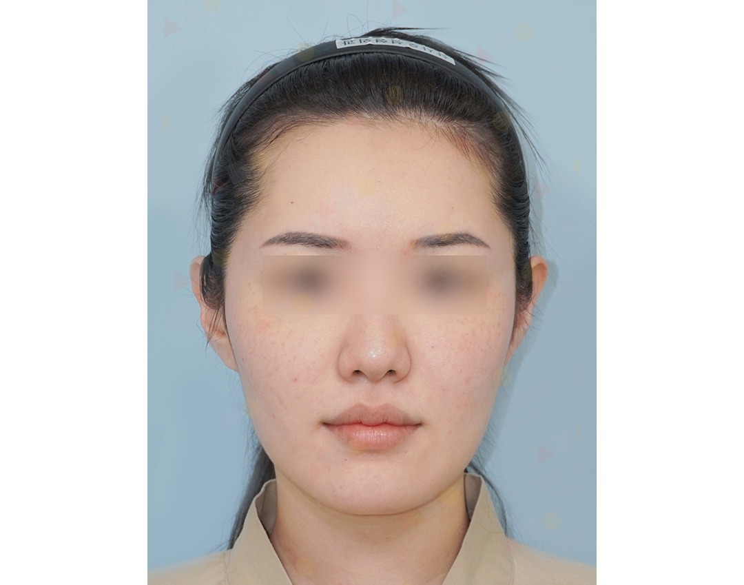 Woman with headband and blurred eyes