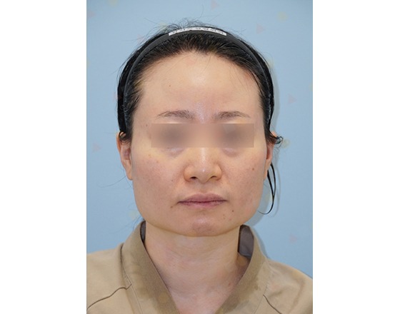 Person with neutral expression wearing a headband.