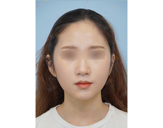 Portrait of a person with long hair and fair skin.