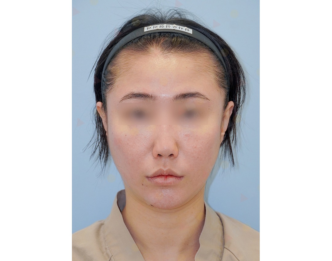 Person with headband, neutral expression, front view