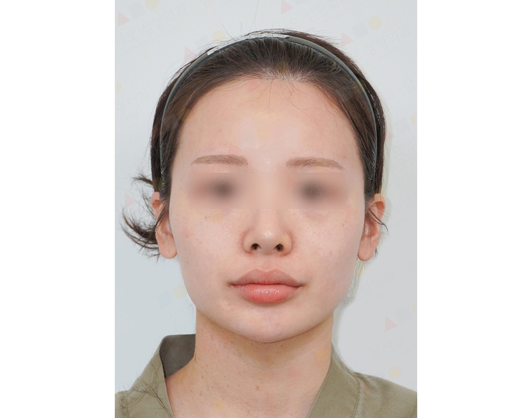 Front view of person with blurred eyes and headband.