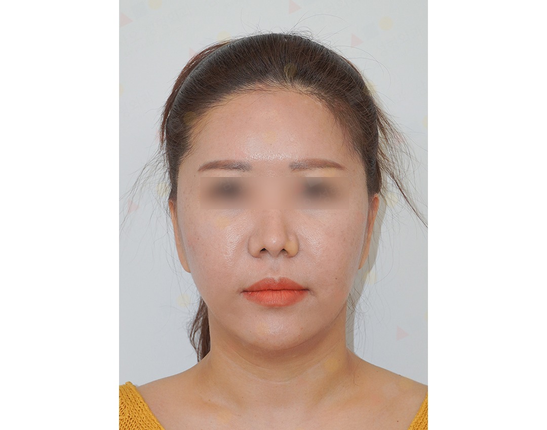 Woman with blurred eyes facing camera