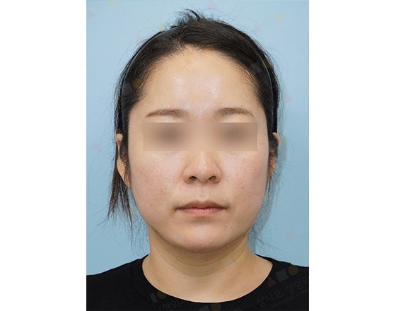 Portrait of a person with blurred eyes.