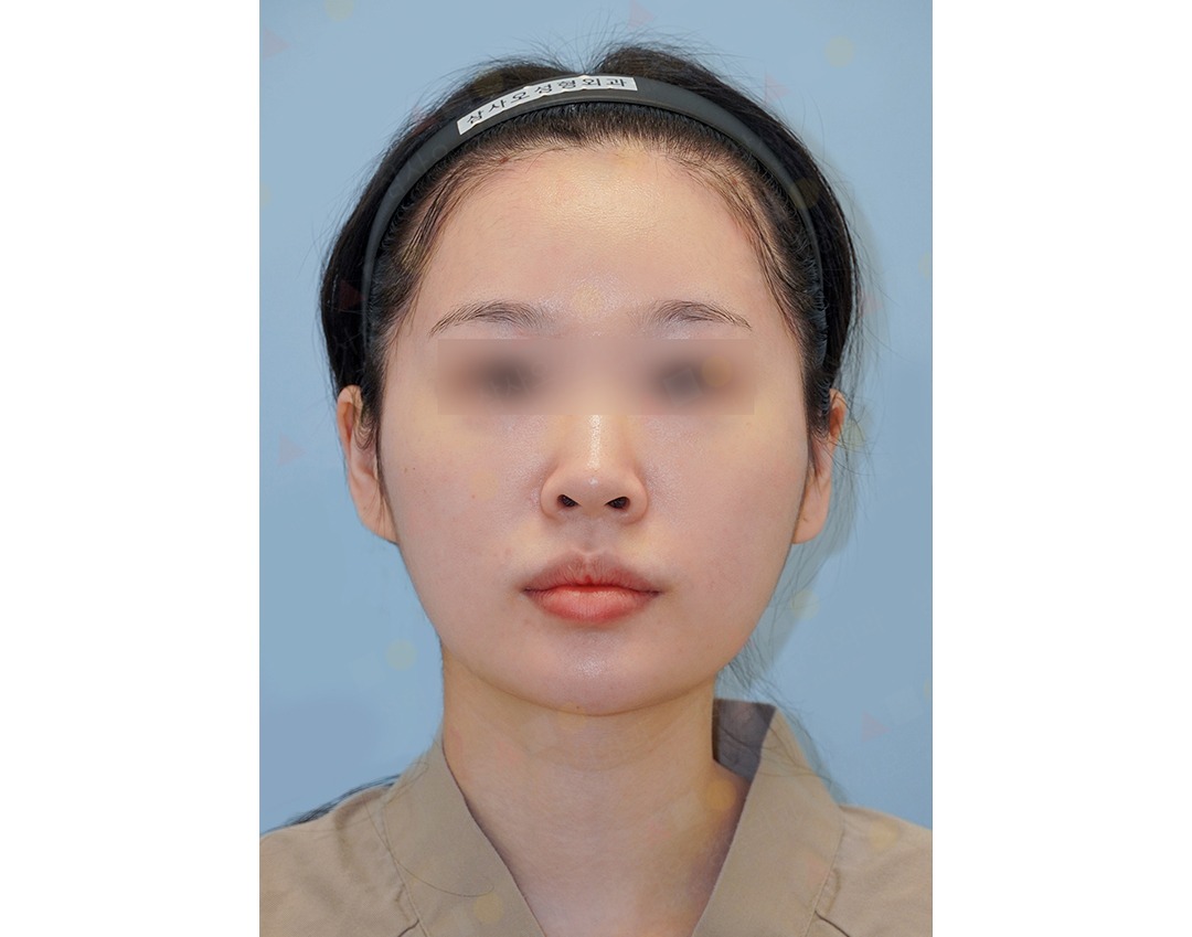 Person with headband and blurred eyes in portrait