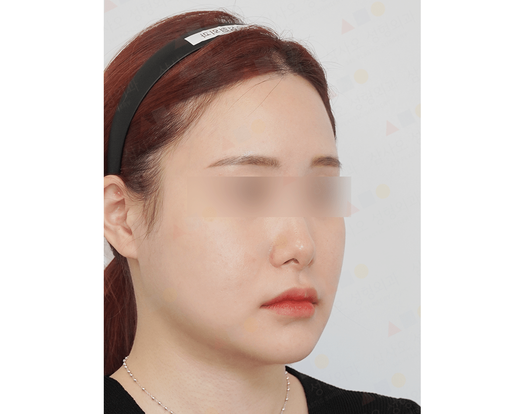 Young person with headband side profile