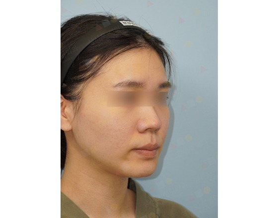 Person with blurred eyes wearing a headband