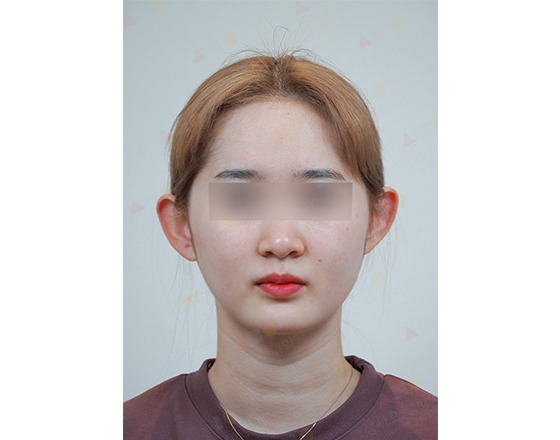 Person with blurred eyes, studio background.