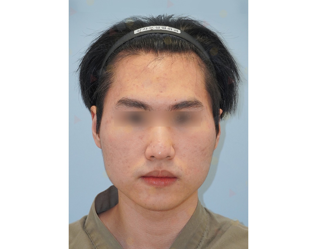 Person with headband, neutral expression.