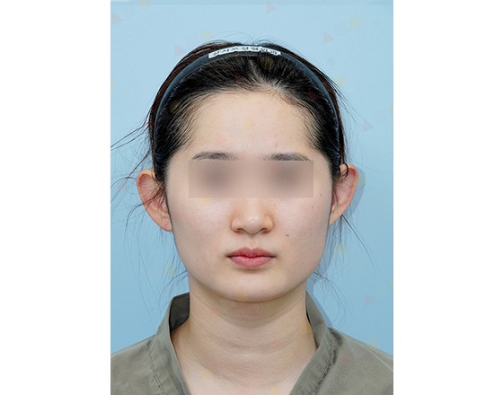 Person with headband and blurred eyes on blue background.