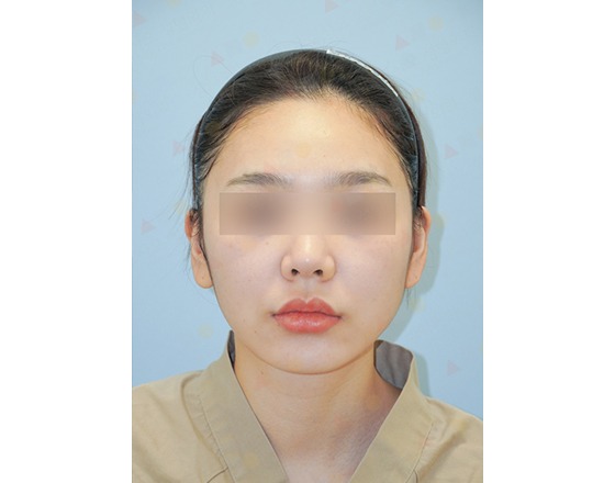 Woman with blurred eyes, headband, neutral expression.
