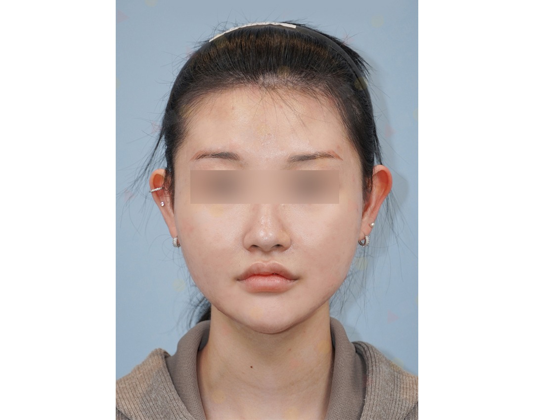 Person with pierced ears and headband, neutral expression.