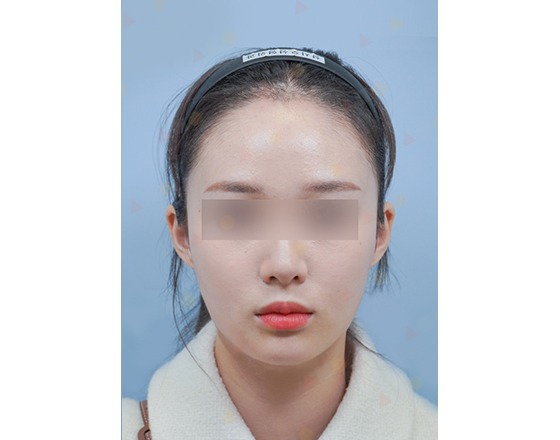 Person with blurred eyes and headband, neutral expression.