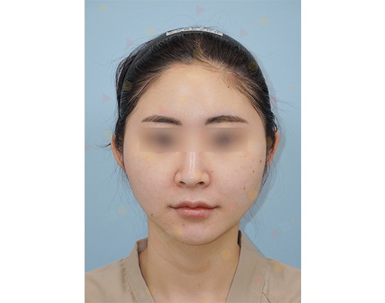 Woman with blurred eyes in a headband
