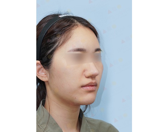 Person with blurred face wearing headband, side profile