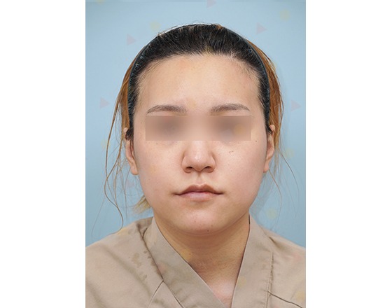 Person with blurred eyes against blue triangle background.