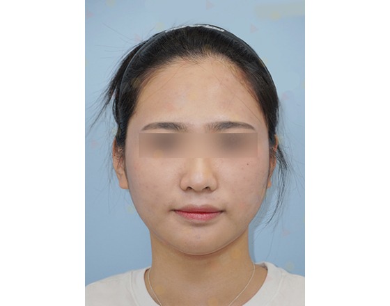 Portrait of person with blurred eyes on blue background.