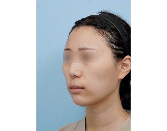 Person with headband on blue background
