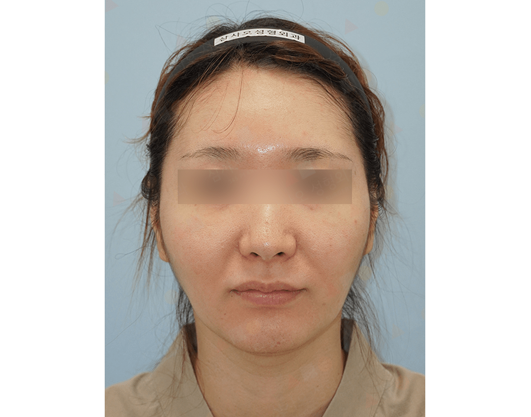 Person with headband facing camera, neutral expression.