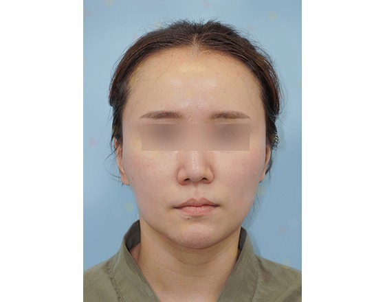 Portrait of person with pixelated eyes, neutral expression.