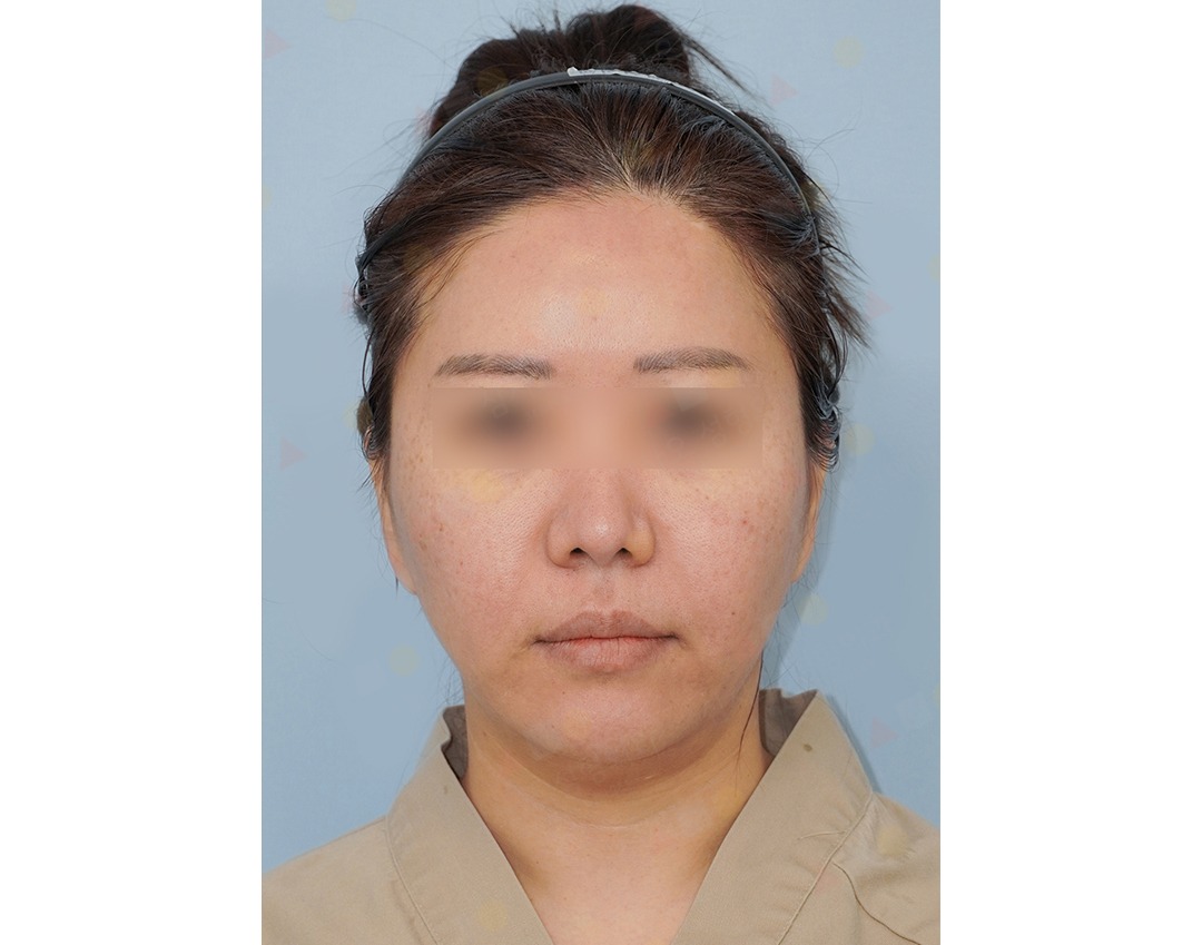Person with neutral expression wearing a headband.