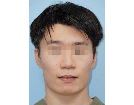 Portrait of a person with pixelated eyes.