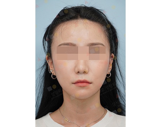 Portrait of a person with blurred eyes.