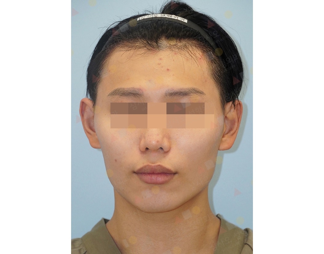 Person with blurred eyes wearing a headband