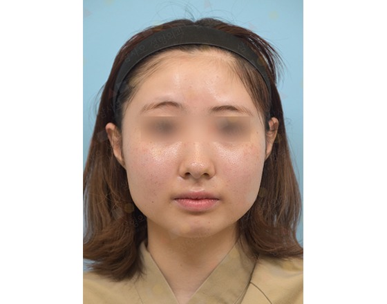 Person with blurred face, wearing a headband.