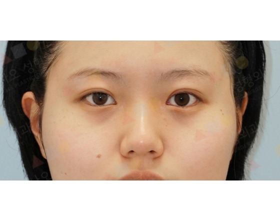 Close-up of person's eyes and face