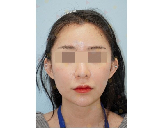 Portrait of a woman with blurred eyes.