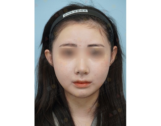 Young woman with hairband, neutral expression.