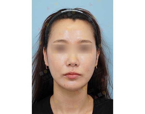 Close-up of person's face front view.