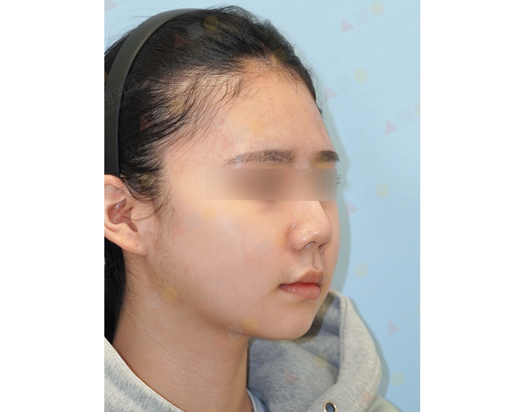 Woman with headband, side profile view.