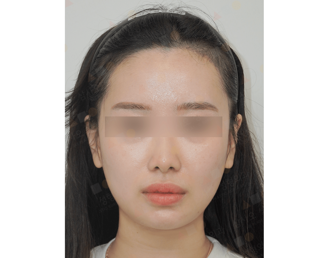 Woman with blurred eyes, wearing headband