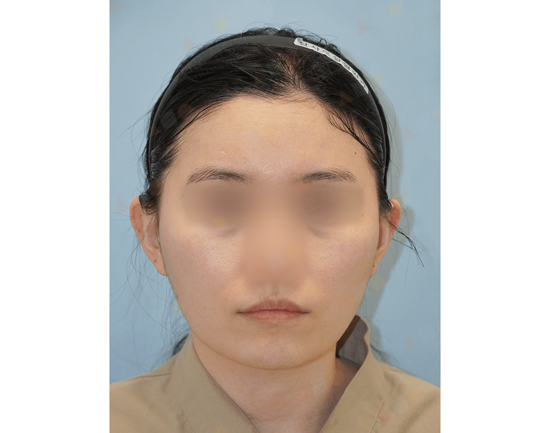 Person with a headband facing forward.